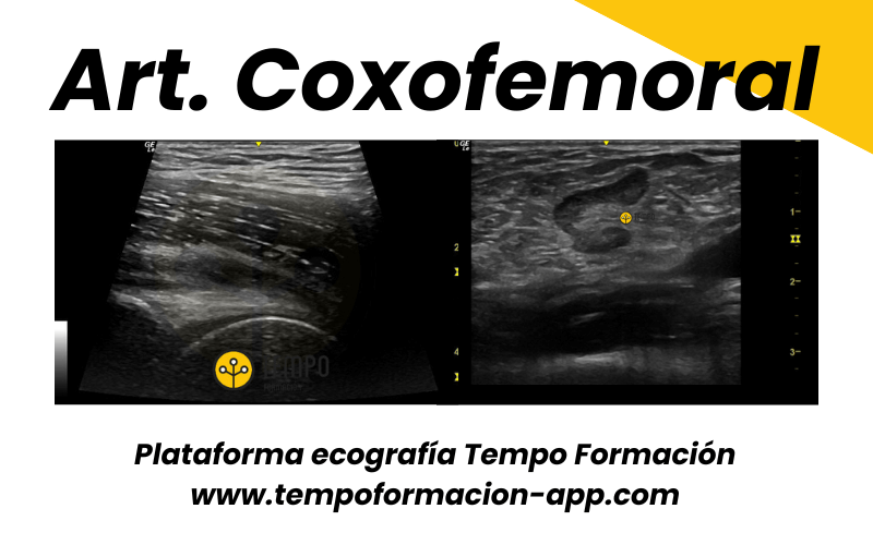 7.  Ecografia Tempo Formacion Articulacion Coxofemoral.png